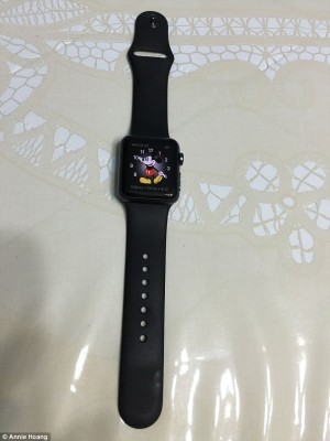 Apple Watch burnt wrist2