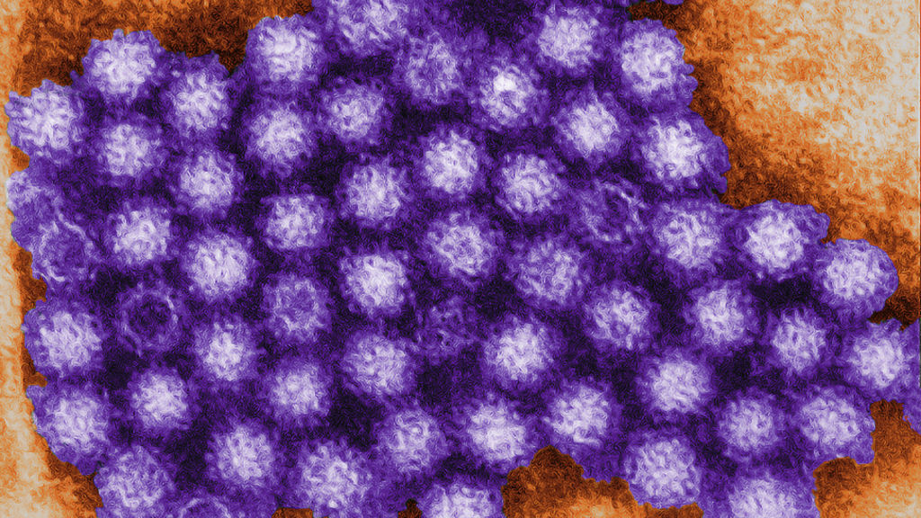 Charles D. Humphrey This transmission electron micrograph (TEM) revealed some of the ultrastructural morphology displayed by norovirus virions, or virus particles.Noroviruses belong to the genus Norovirus, and the family Caliciviridae. They are a group of related, single-stranded RNA, nonenveloped viruses that cause acute gastroenteritis in humans. Norovirus was recently approved as the official genus name for the group of viruses provisionally described as “Norwalk-like viruses” (NLV). What are noroviruses?Noroviruses are a group of viruses that cause the “stomach flu,” or gastroenteritis (GAS-tro-en-ter-I-tis), in people. The term norovirus was recently approved as the official name for this group of viruses. Several other names have been used for noroviruses, including:- Norwalk-like viruses (NLVs) - caliciviruses (because they belong to the virus family Caliciviridae- small round structured viruses.Viruses are very different from bacteria and parasites, some of which can cause illnesses similar to norovirus infection. Like all viral infections, noroviruses are not affected by treatment with antibiotics, and cannot grow outside of a person’s body.
