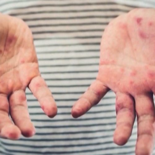 КОРЬ ОПЯТЬ ДОБРАЛААСЬ ДО АЭРОПОРТА PEARSON В ТОРОНТО